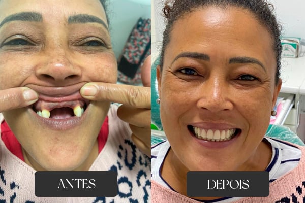Antes e depois de tratamento odontológico