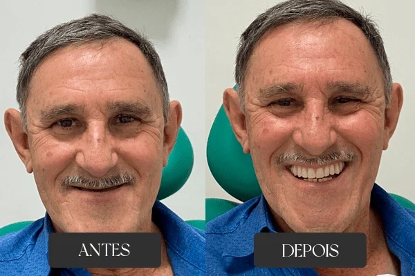 Antes e depois de tratamento odontológico